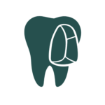 Facetas Dentária